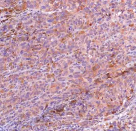 Anti-MAGE 1 antibody used in IHC (Paraffin sections) (IHC-P). GTX16031